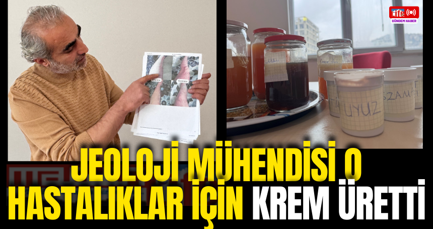 Jeoloji mühendisi o hastalıklar için krem üretti