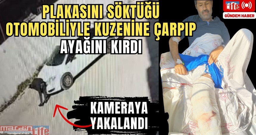 Plakasını söktüğü otomobiliyle kuzenine çarpıp ayağını kırdı