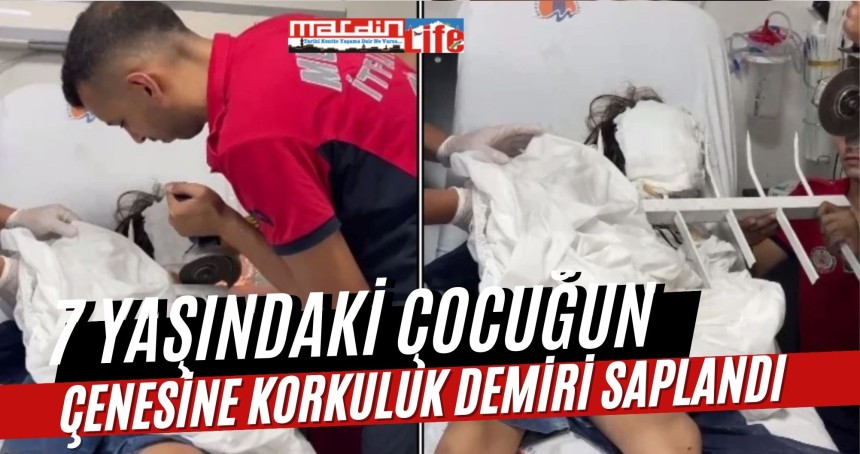 7 yaşındaki çocuğun çenesine korkuluk demiri saplandı