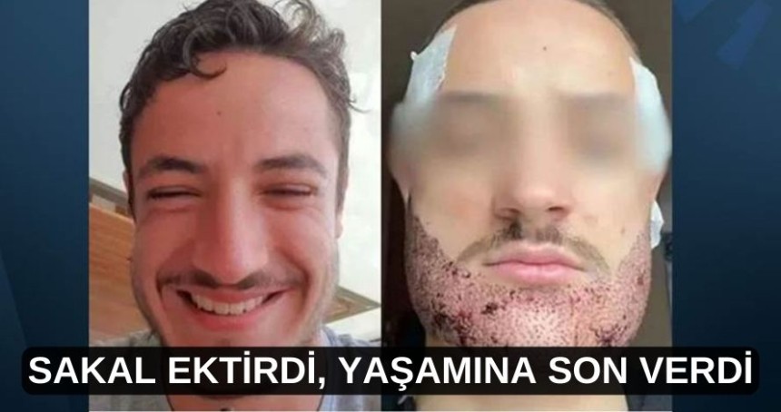 Sakal ektikten sonra yaşamına son verdi