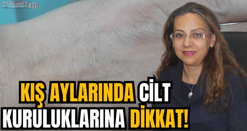 Kış aylarında cilt kuruluklarına dikkat!